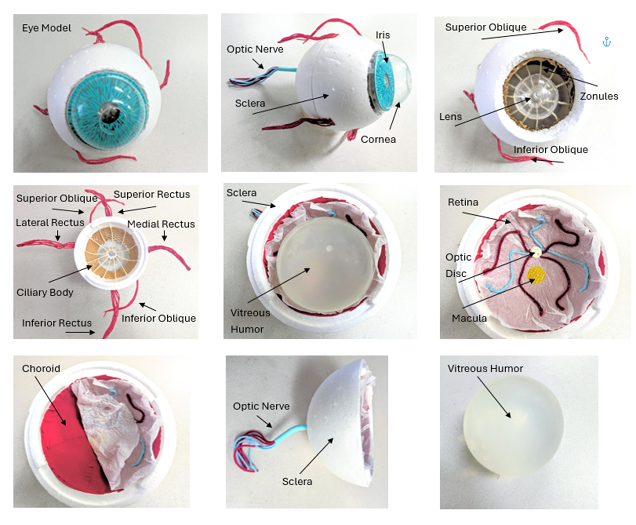 Close up photos of each section of the model. Includes sclera made from styrofoam, choroid made from red paper, retina made from tissue paper, and cornea made from clear bowl with a hole in center, amongst many others
