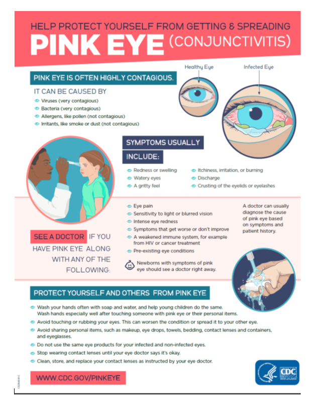 Stop the spread of Pink eye.