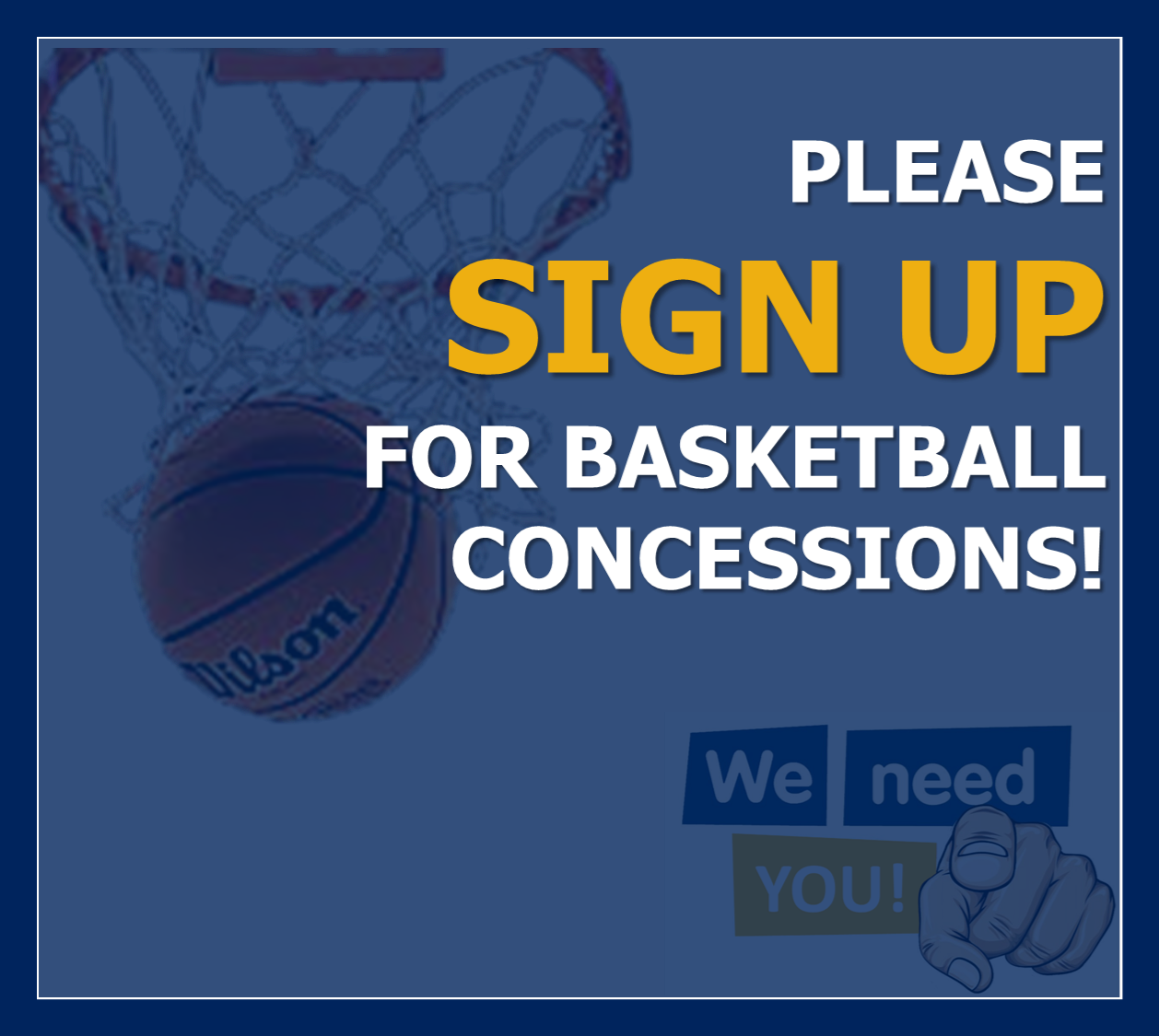 concessions